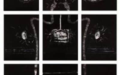 Epilepsy Portraits By Susan Aldworth To Be Displayed At NPG